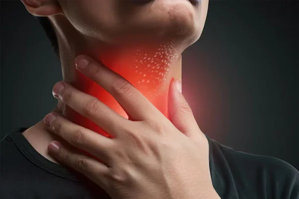 Throat and Oral Cavity