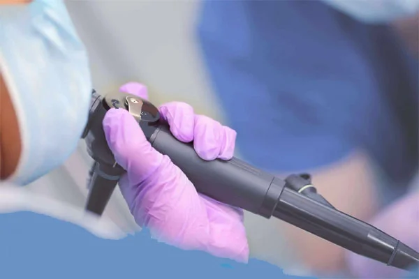 Sleep Endoscopy