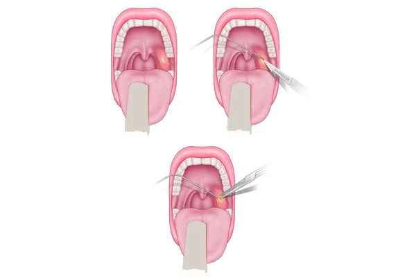 Throat